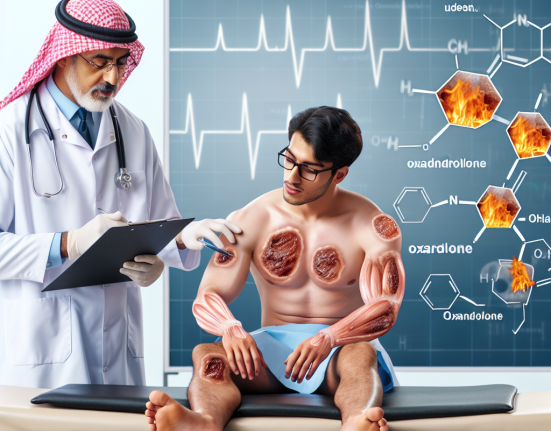 Wie Oxandrolon bei der Behandlung von Verbrennungsopfern eingesetzt wird
